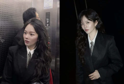 Jung Ji So surpreende fãs com novo visual e gera especulações sobre cirurgia plástica